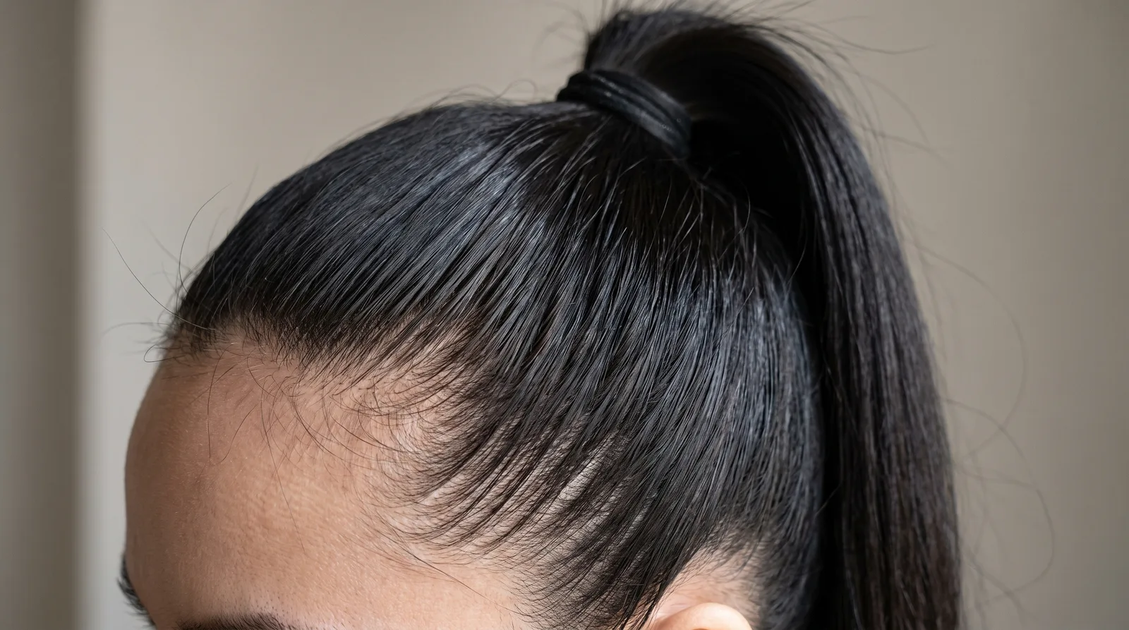 Hair pulled into a very tight high ponytail, the hairline visibly taut